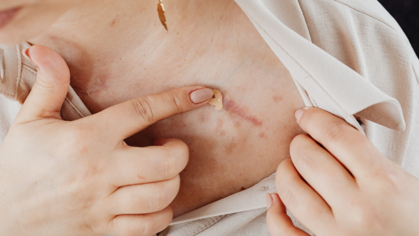 Medicina regenerativa e cicatrização moderna aplicadas à cirurgia plástica, segundo Milton Seigi Hayashi.